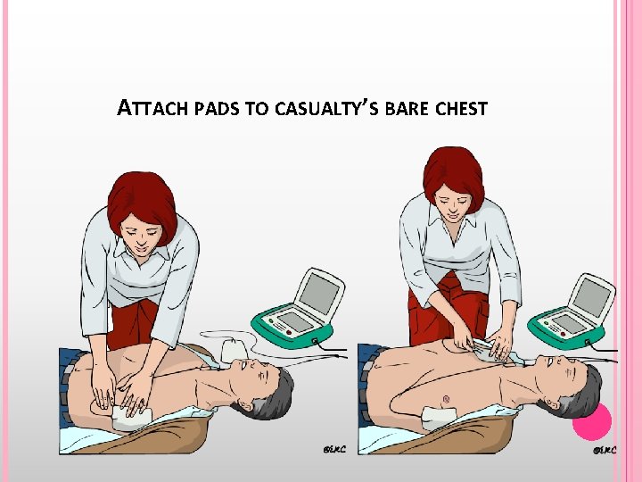 ATTACH PADS TO CASUALTY’S BARE CHEST 