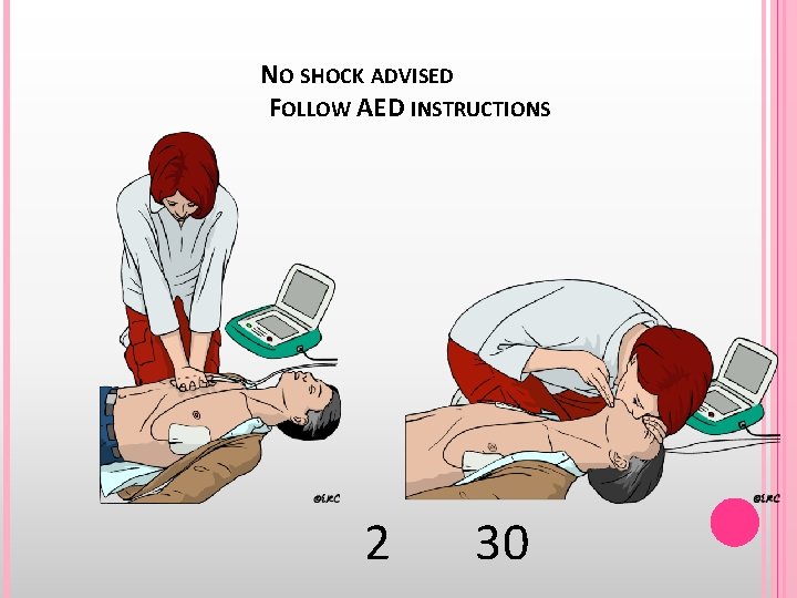 NO SHOCK ADVISED FOLLOW AED INSTRUCTIONS 2 30 