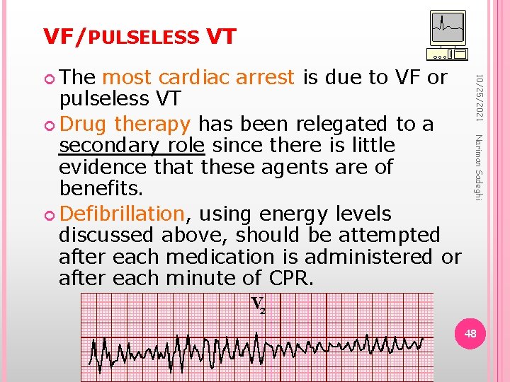 VF/PULSELESS VT Nariman Sadeghi most cardiac arrest is due to VF or pulseless VT