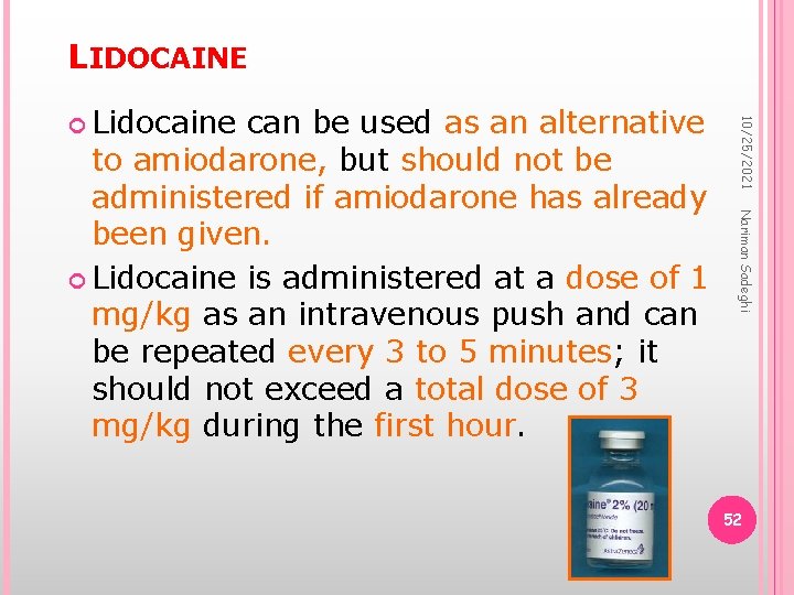 LIDOCAINE Nariman Sadeghi can be used as an alternative to amiodarone, but should not