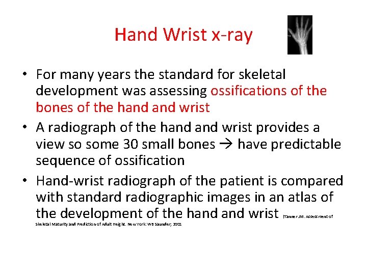 Hand Wrist x-ray • For many years the standard for skeletal development was assessing