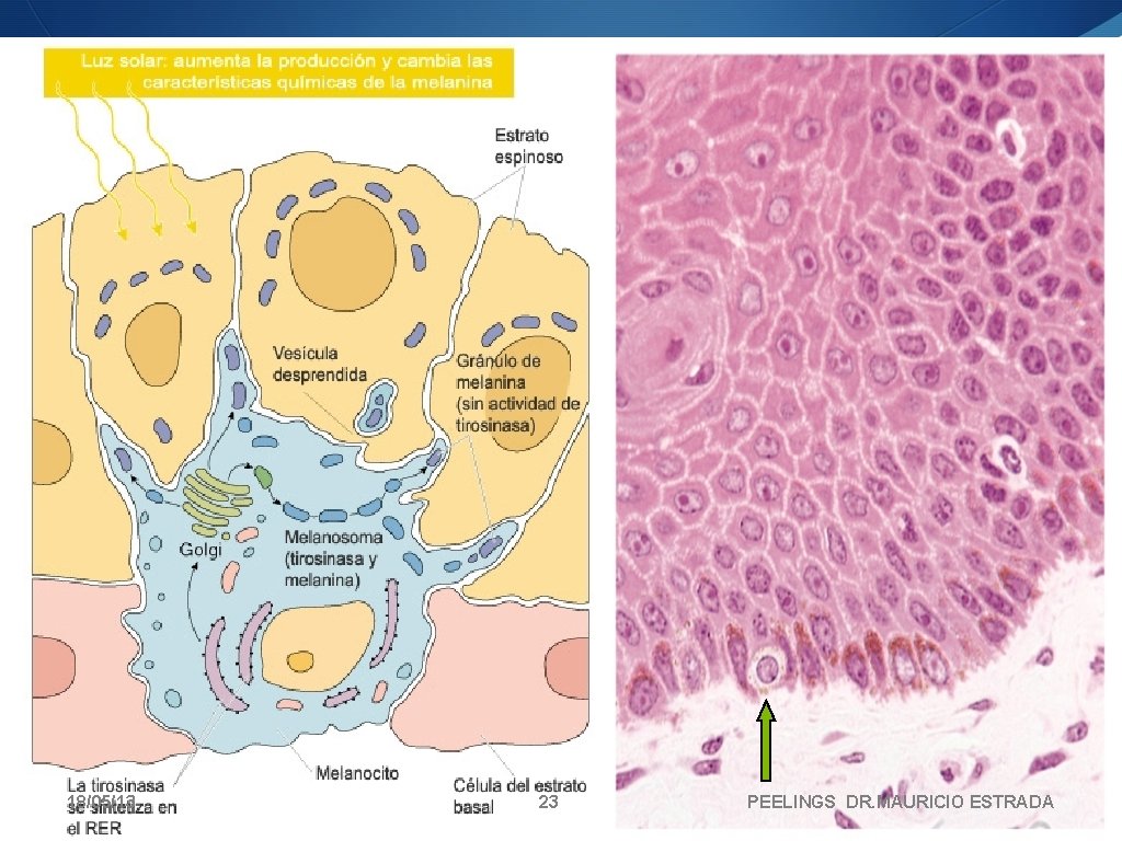 18/05/13 23 PEELINGS DR. MAURICIO ESTRADA 