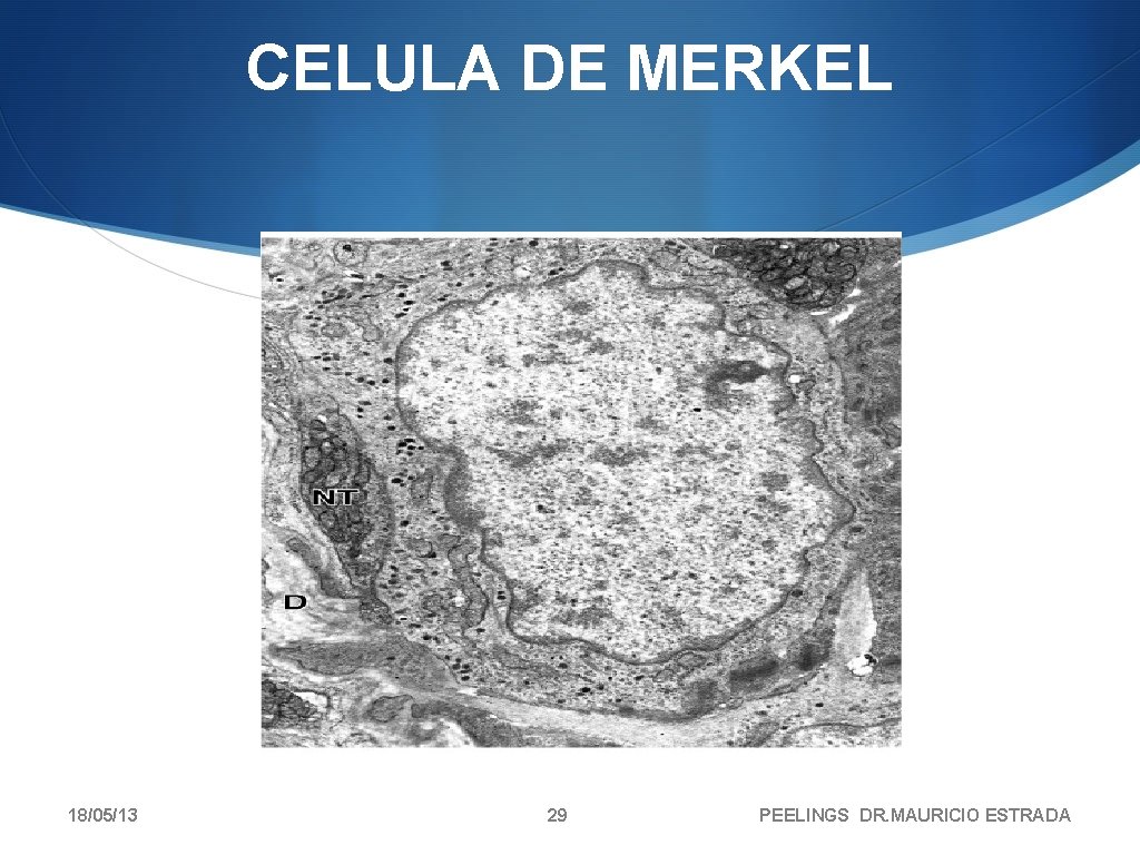 CELULA DE MERKEL 18/05/13 29 PEELINGS DR. MAURICIO ESTRADA 