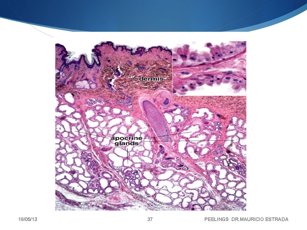 18/05/13 37 PEELINGS DR. MAURICIO ESTRADA 