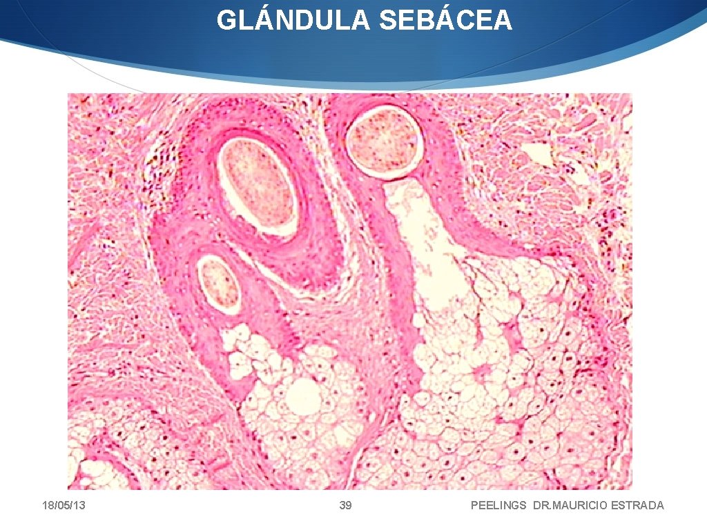 GLÁNDULA SEBÁCEA 18/05/13 39 PEELINGS DR. MAURICIO ESTRADA 