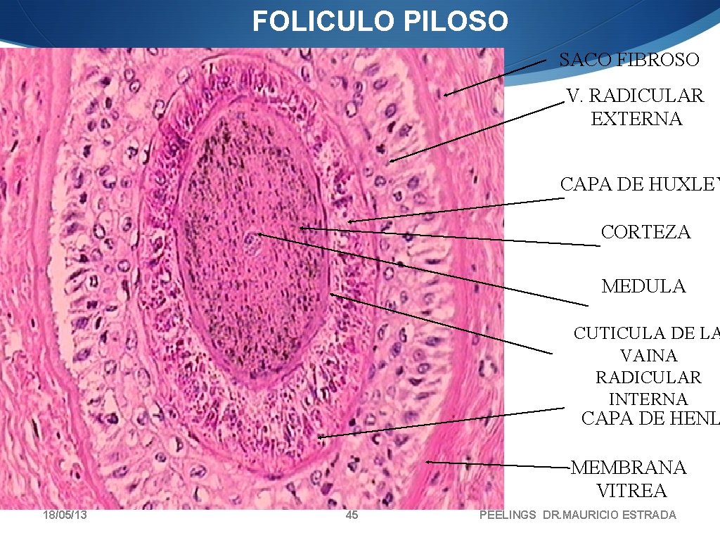 FOLICULO PILOSO SACO FIBROSO V. RADICULAR EXTERNA CAPA DE HUXLEY CORTEZA MEDULA CUTICULA DE