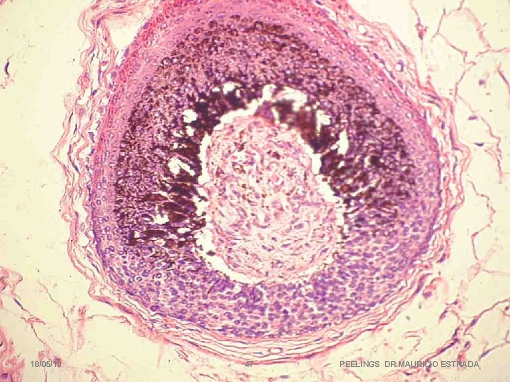 18/05/13 47 PEELINGS DR. MAURICIO ESTRADA 