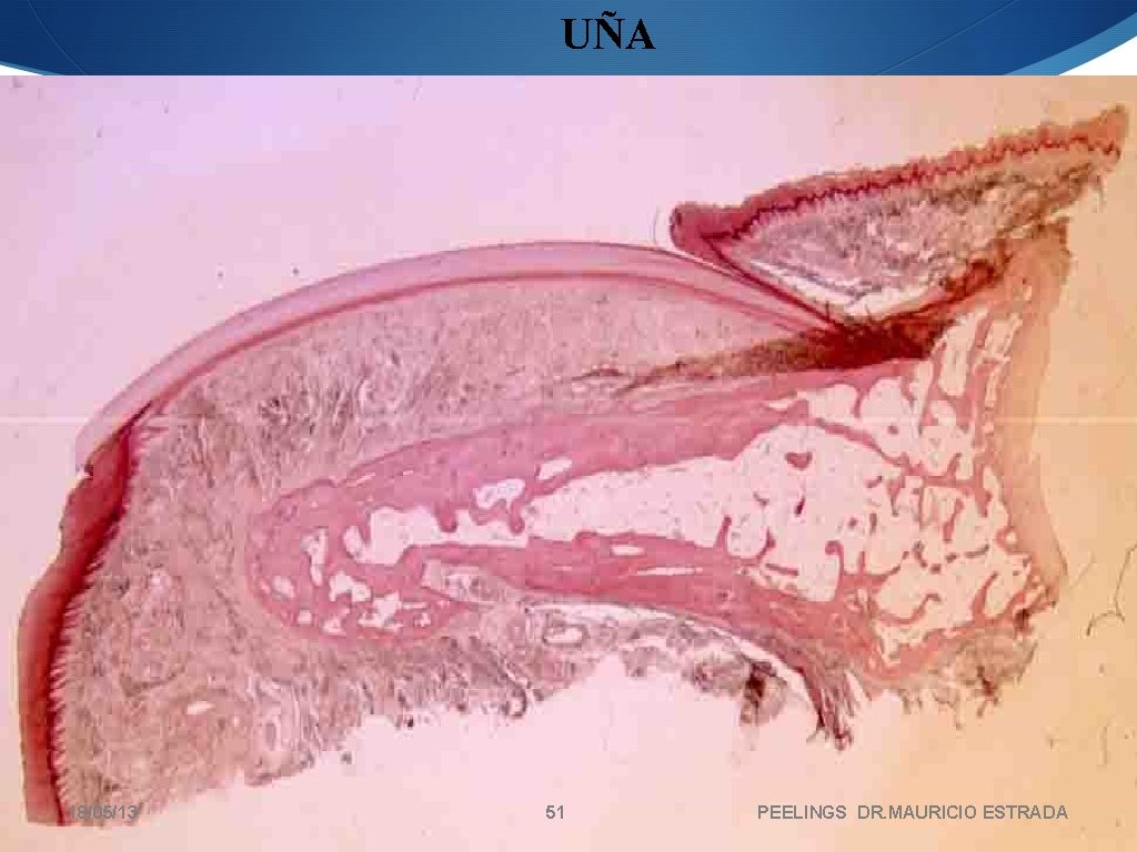 UÑA 18/05/13 51 PEELINGS DR. MAURICIO ESTRADA 