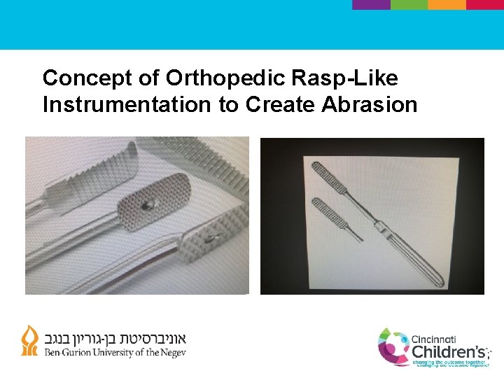 Concept of Orthopedic Rasp-Like Instrumentation to Create Abrasion 