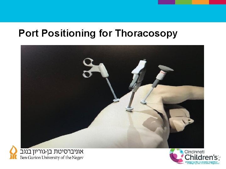 Port Positioning for Thoracosopy 