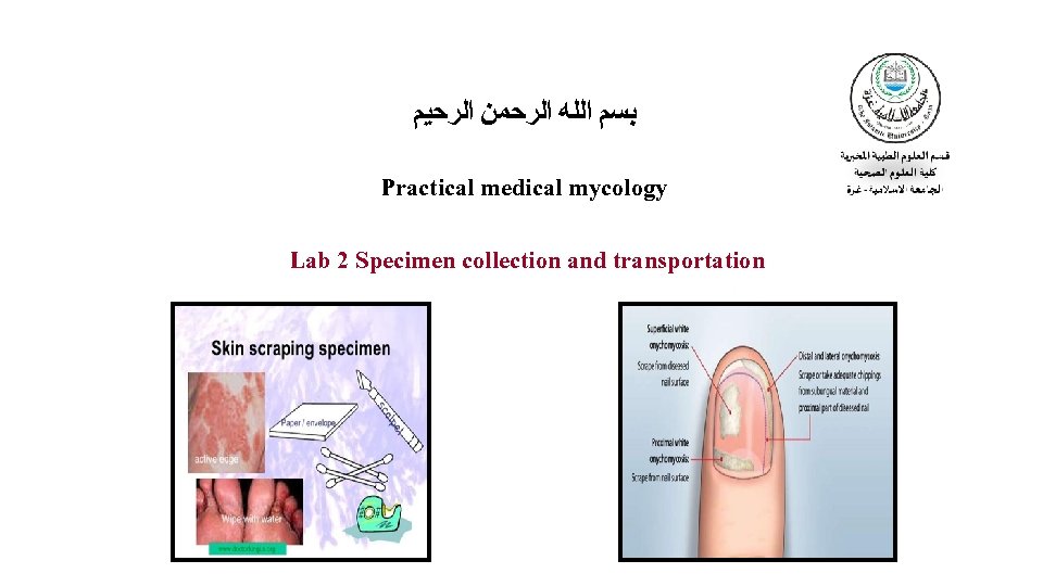  ﺑﺴﻢ ﺍﻟﻠﻪ ﺍﻟﺮﺣﻤﻦ ﺍﻟﺮﺣﻴﻢ Practical medical mycology Lab 2 Specimen collection and transportation