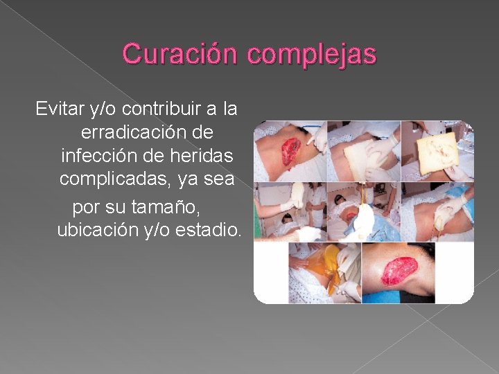 Curación complejas Evitar y/o contribuir a la erradicación de infección de heridas complicadas, ya