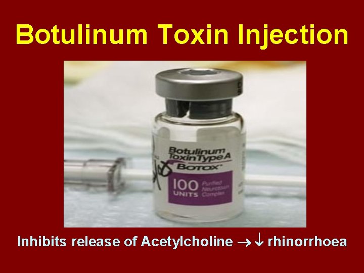 Botulinum Toxin Injection Inhibits release of Acetylcholine rhinorrhoea 