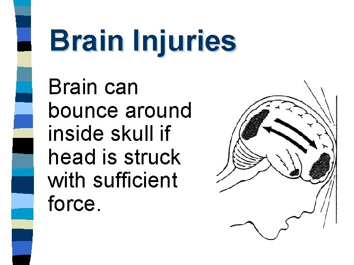 Brain Injuries Brain can bounce around inside skull if head is struck with sufficient