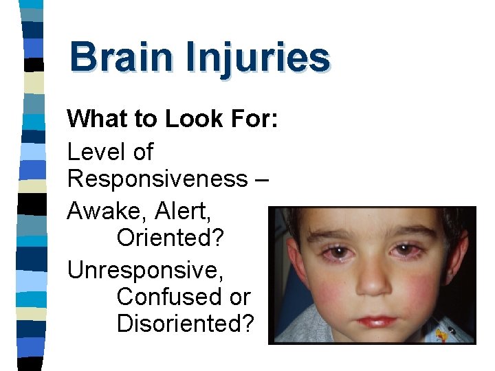 Brain Injuries What to Look For: Level of Responsiveness – Awake, Alert, Oriented? Unresponsive,