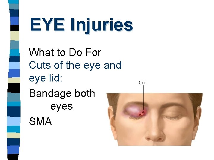 EYE Injuries What to Do For Cuts of the eye and eye lid: Bandage
