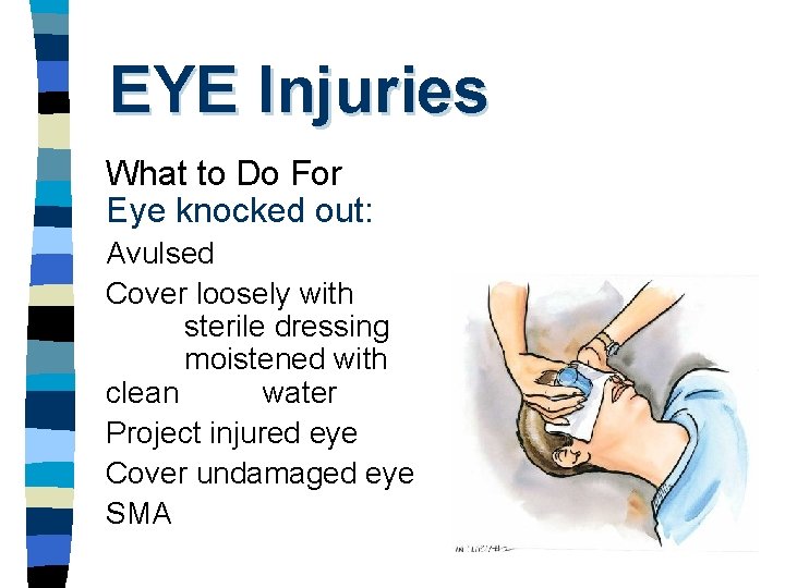 EYE Injuries What to Do For Eye knocked out: Avulsed Cover loosely with sterile