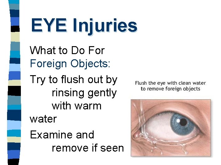 EYE Injuries What to Do Foreign Objects: Try to flush out by rinsing gently