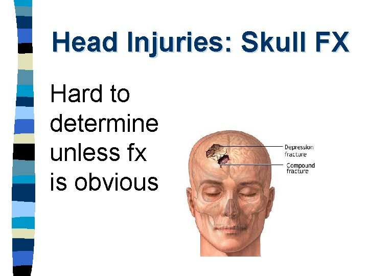 Head Injuries: Skull FX Hard to determine unless fx is obvious 