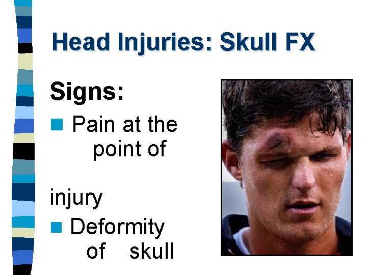 Head Injuries: Skull FX Signs: n Pain at the point of injury n Deformity