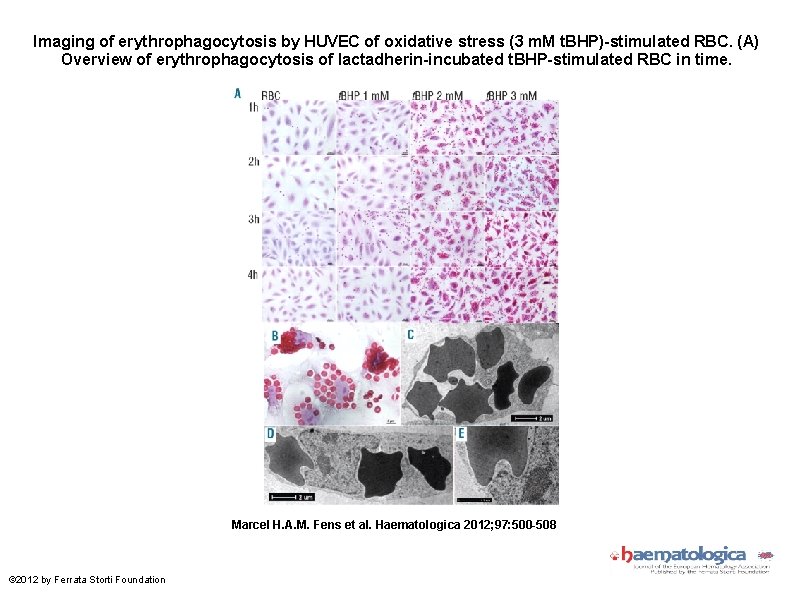 Imaging of erythrophagocytosis by HUVEC of oxidative stress (3 m. M t. BHP)-stimulated RBC.