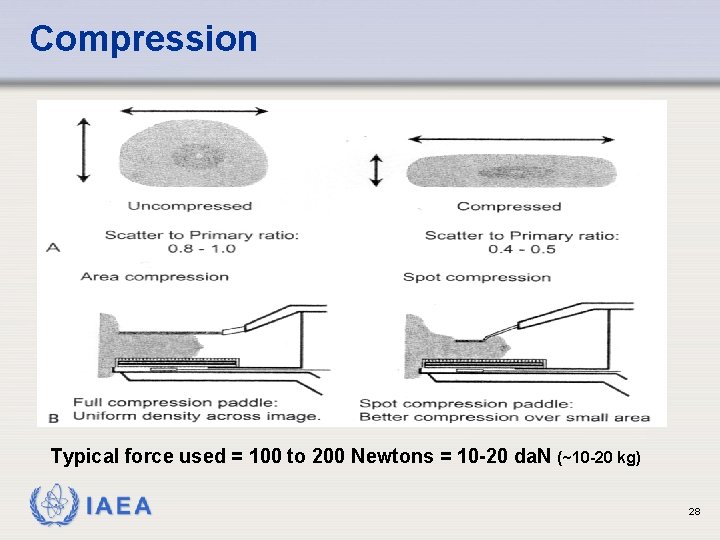 Compression Typical force used = 100 to 200 Newtons = 10 -20 da. N