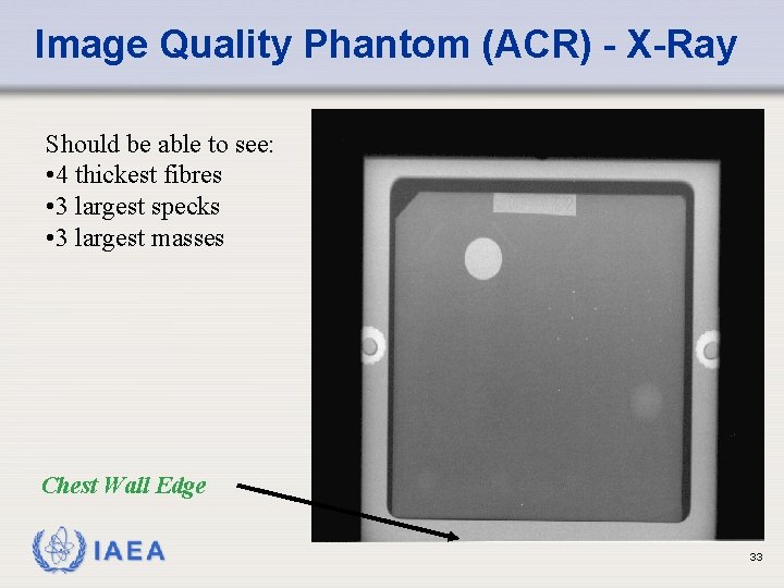 Image Quality Phantom (ACR) - X-Ray Should be able to see: • 4 thickest