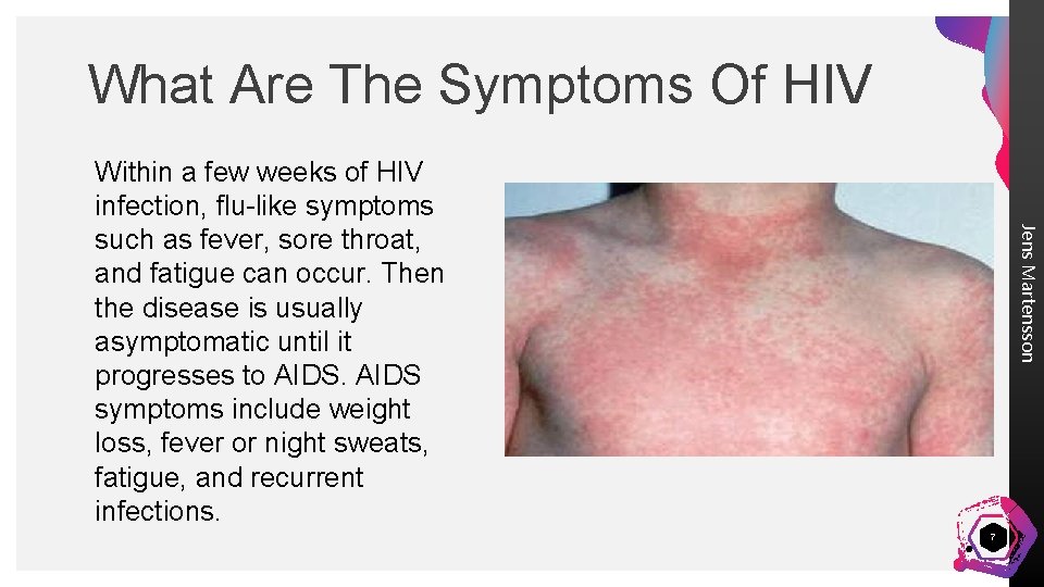 What Are The Symptoms Of HIV Jens Martensson Within a few weeks of HIV