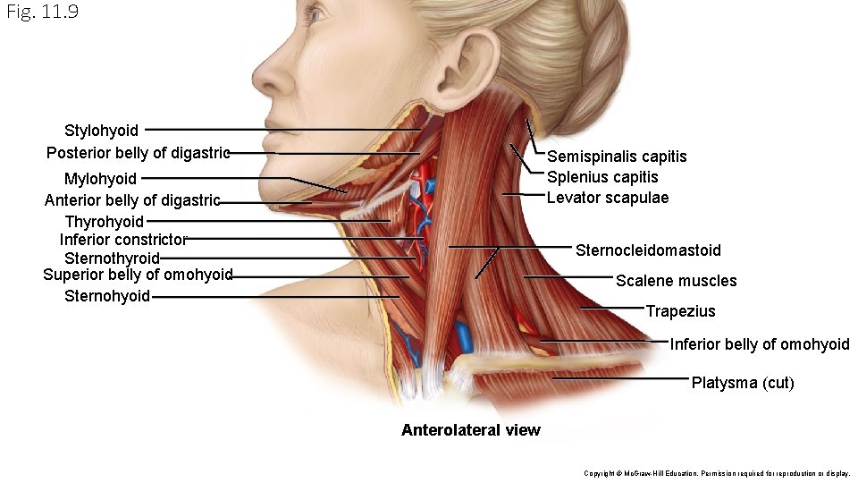 Fig. 11. 9 Stylohyoid Posterior belly of digastric Semispinalis capitis Splenius capitis Levator scapulae Fig. 11. 9 Stylohyoid Posterior belly of digastric Semispinalis capitis Splenius capitis Levator scapulae