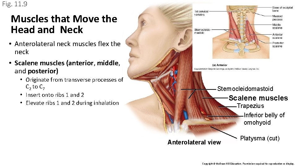 Fig. 11. 9 Muscles that Move the Head and Neck • Anterolateral neck muscles Fig. 11. 9 Muscles that Move the Head and Neck • Anterolateral neck muscles