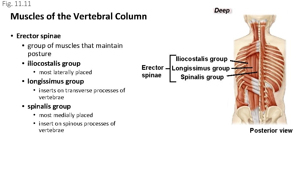 Fig. 11 Muscles of the Vertebral Column • Erector spinae • group of muscles Fig. 11 Muscles of the Vertebral Column • Erector spinae • group of muscles