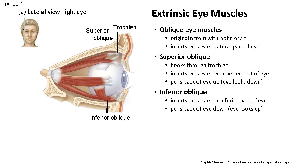 Fig. 11. 4 (a) Lateral view, right eye Extrinsic Eye Muscles Superior oblique Trochlea Fig. 11. 4 (a) Lateral view, right eye Extrinsic Eye Muscles Superior oblique Trochlea