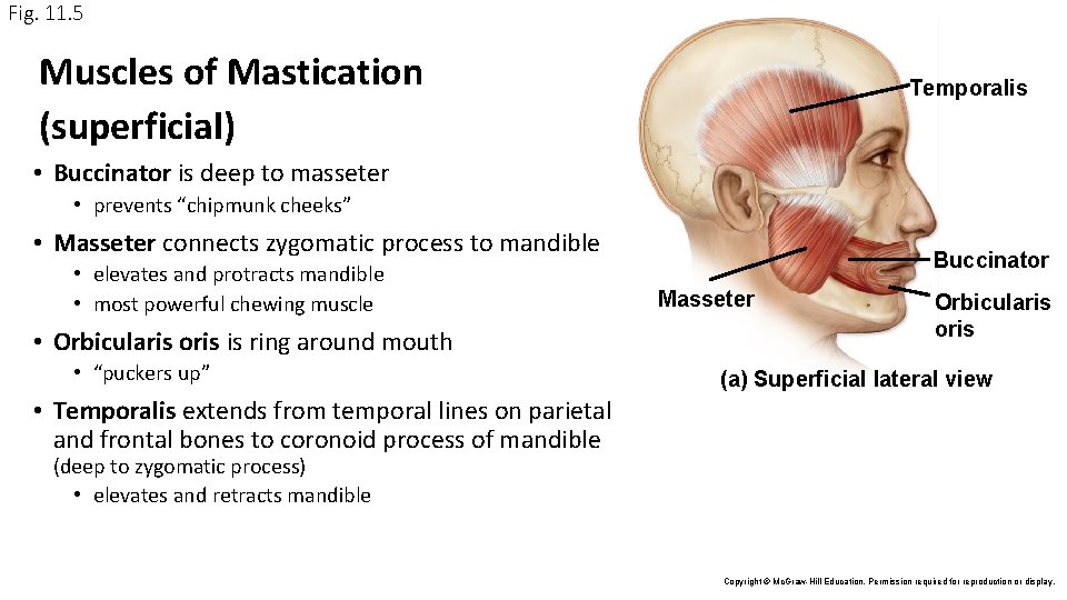Fig. 11. 5 Muscles of Mastication (superficial) Temporalis • Buccinator is deep to masseter Fig. 11. 5 Muscles of Mastication (superficial) Temporalis • Buccinator is deep to masseter