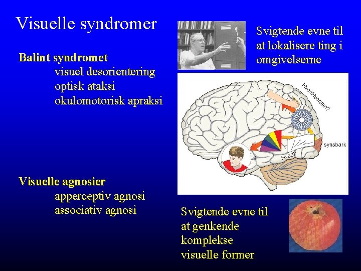 Visuelle syndromer Balint syndromet visuel desorientering optisk ataksi okulomotorisk apraksi Visuelle agnosier apperceptiv agnosi