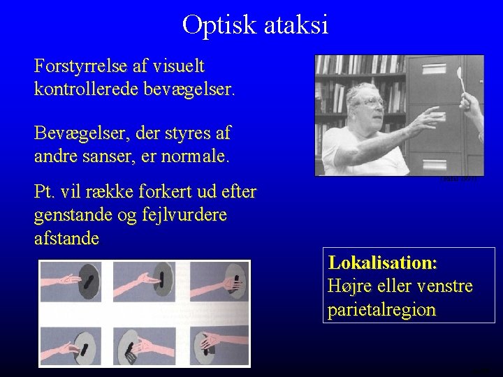 Optisk ataksi Forstyrrelse af visuelt kontrollerede bevægelser. Bevægelser, der styres af andre sanser, er