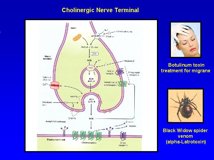 Cholinergic Nerve Terminal Botulinum toxin treatment for migrane Black Widow spider venom (alpha-Latrotoxin) 