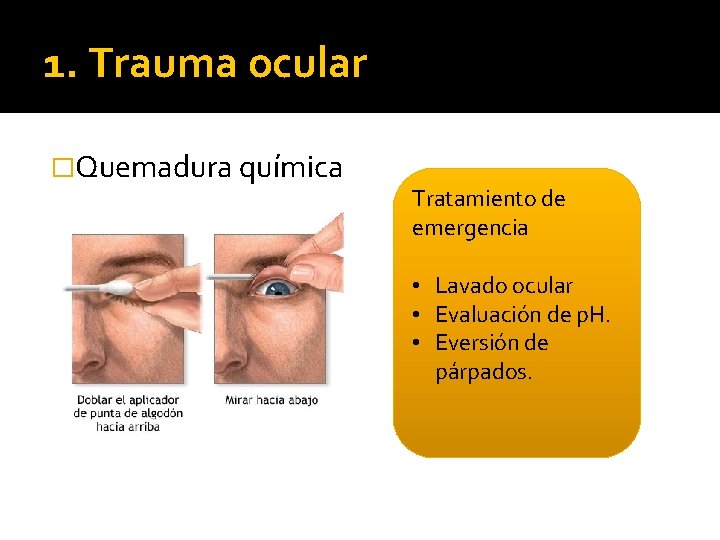 1. Trauma ocular �Quemadura química Tratamiento de emergencia • Lavado ocular • Evaluación de