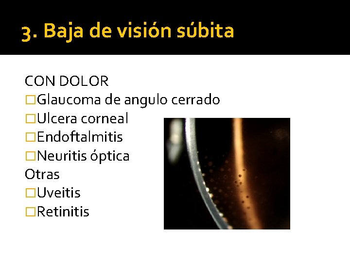 3. Baja de visión súbita CON DOLOR �Glaucoma de angulo cerrado �Ulcera corneal �Endoftalmitis