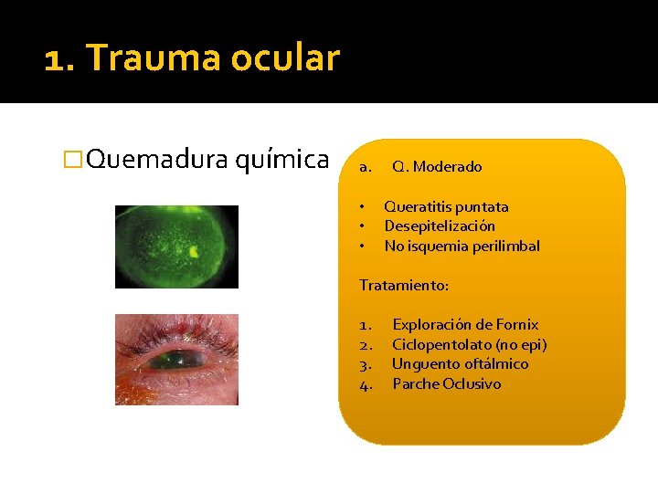 1. Trauma ocular �Quemadura química a. • • • Q. Moderado Queratitis puntata Desepitelización