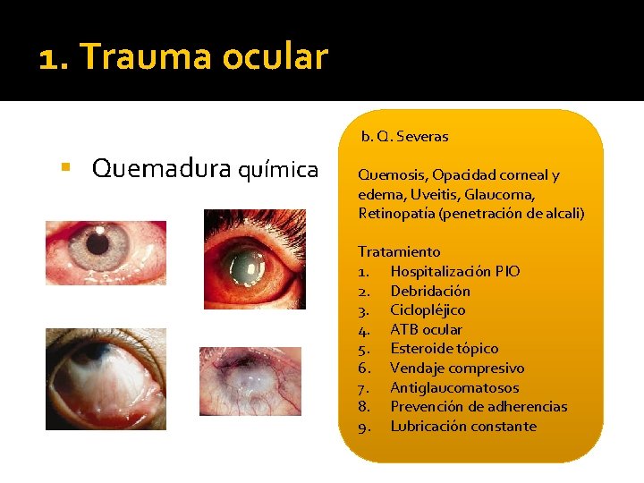 1. Trauma ocular b. Q. Severas § Quemadura química Quemosis, Opacidad corneal y edema,