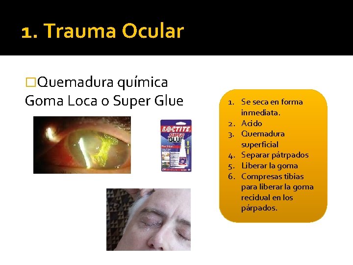 1. Trauma Ocular �Quemadura química Goma Loca o Super Glue 1. Se seca en