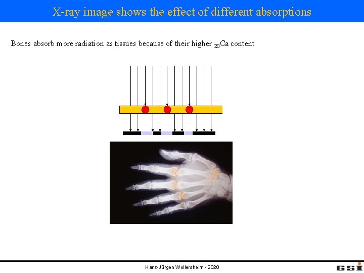 X-ray image shows the effect of different absorptions Bones absorb more radiation as tissues