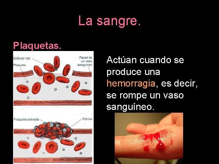 La sangre. Plaquetas. Actúan cuando se produce una hemorragia, es decir, se rompe un