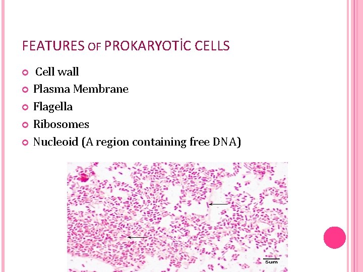 FEATURES OF PROKARYOTİC CELLS Cell wall Plasma Membrane Flagella Ribosomes Nucleoid (A region containing