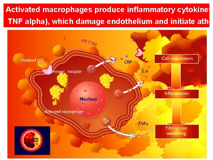 Activated macrophages produce inflammatory cytokines TNF alpha), which damage endothelium and initiate athe 