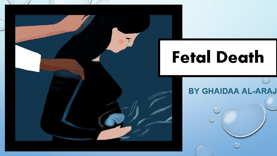 Fetal Death BY GHAIDAA AL-ARAJ 