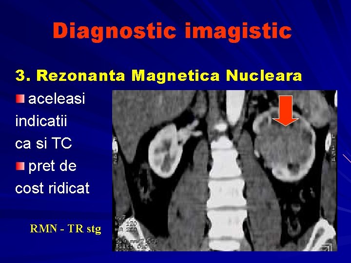 Diagnostic imagistic 3. Rezonanta Magnetica Nucleara aceleasi indicatii ca si TC pret de cost