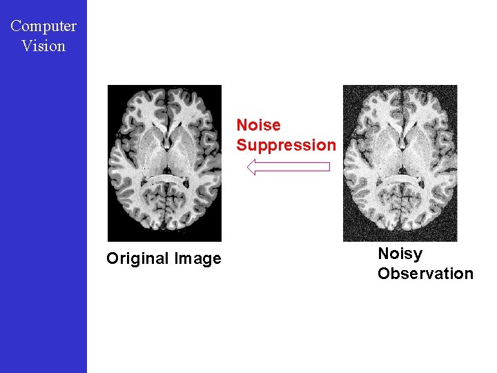 Computer Vision Noise Suppression Original Image Noisy Observation 