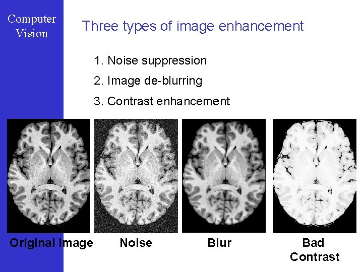 Computer Vision Three types of image enhancement 1. Noise suppression 2. Image de-blurring 3.