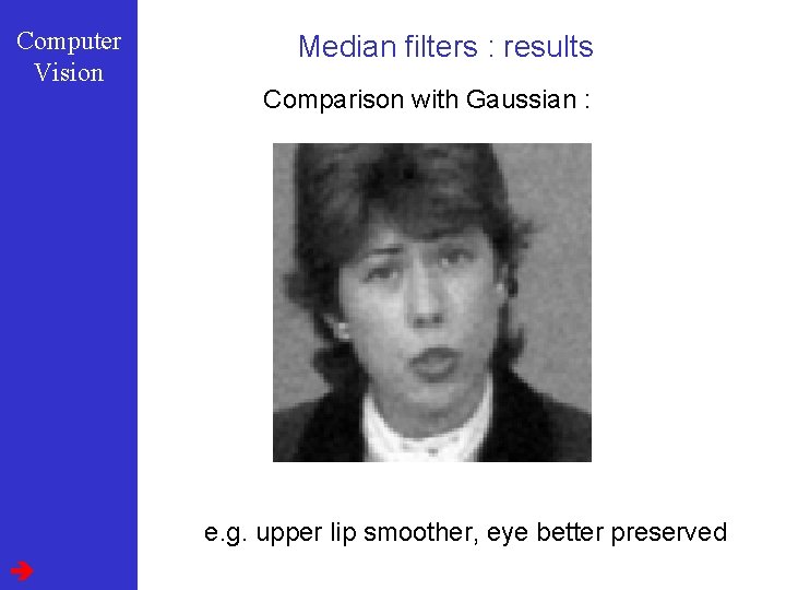 Computer Vision Median filters : results Comparison with Gaussian : e. g. upper lip